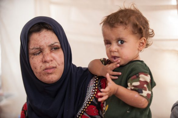 khadija_en_22-arig_mor_til_tre_var_pa_vej_gennem_et_minefelt_med_den_etarige_mahmoud_i_sine_arme_da_eksplosionen_forandrede_deres_liv_for_altid