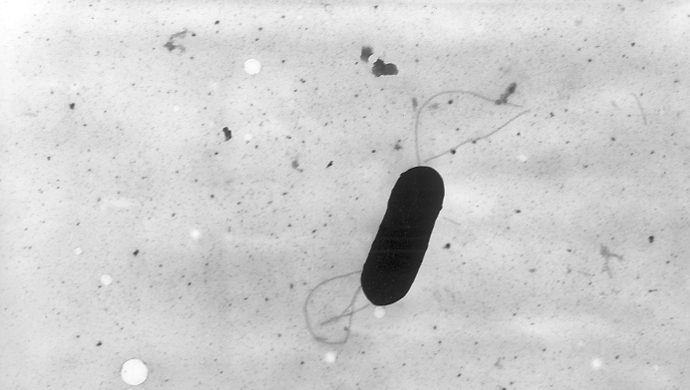 listeria_monocytogenes_phil_2287_lores